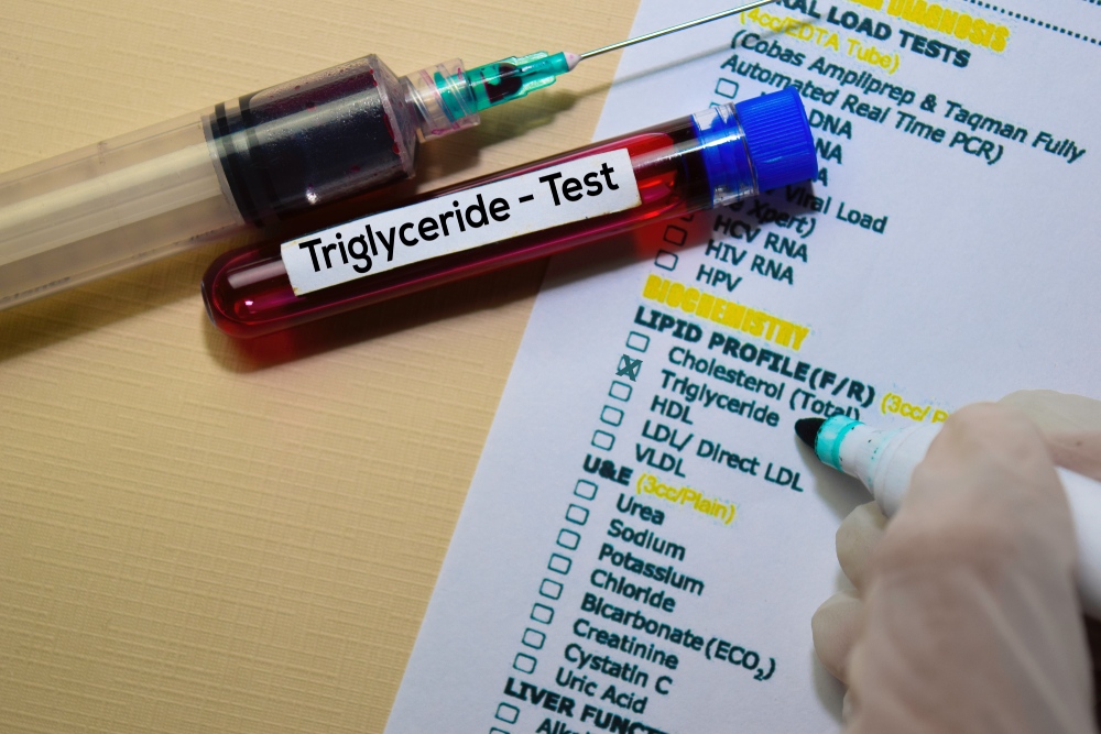 triglyceridy
